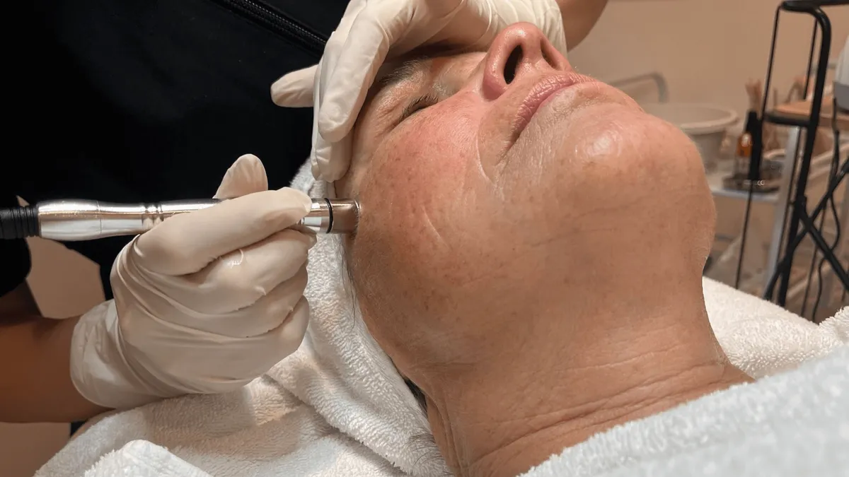 Diamantpeeling_Ansigtsbehandling_Beauty_By_Newgard_Kosmetolog_Ikast